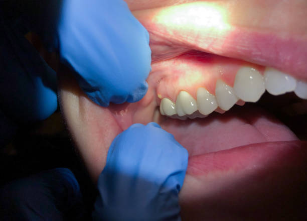  Perry, GA Emergency Dentist Pros