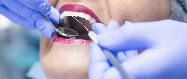 Best Emergency Tooth Extraction in Perry, GA